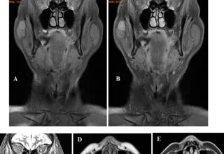Advances in Neuroradiology Research and Clinical Applications