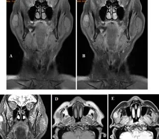 Advances in Neuroradiology Research and Clinical Applications