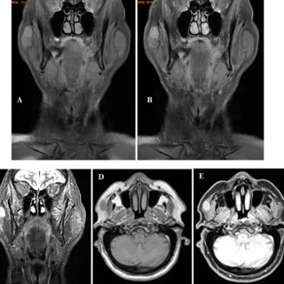 Advances in Neuroradiology Research and Clinical Applications