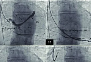 Common Cardiology Treatment Solutions