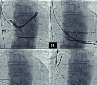 Common Cardiology Treatment Solutions