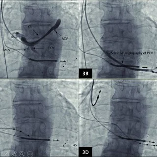 Common Cardiology Treatment Solutions