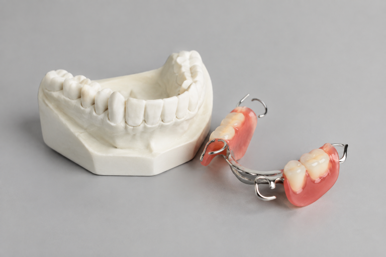 From Loose Dentures to a Secure Smile: A Guide to Full-Arch Tooth Replacement in Catoosa, Oklahoma